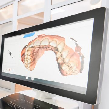 Brampton dental clinic treatment room with digital teeth model