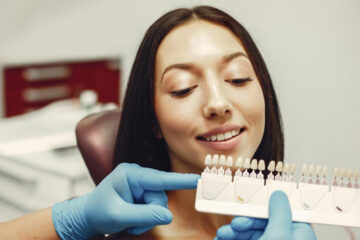 Top 5 Benefits of Choosing Porcelain Veneers