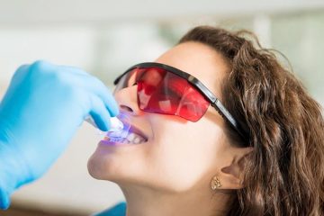 Fast, Safe & Effective Teeth Whitening in Brampton – Here’s How