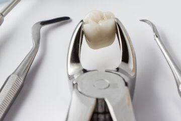 Eat After Wisdom Tooth Removal